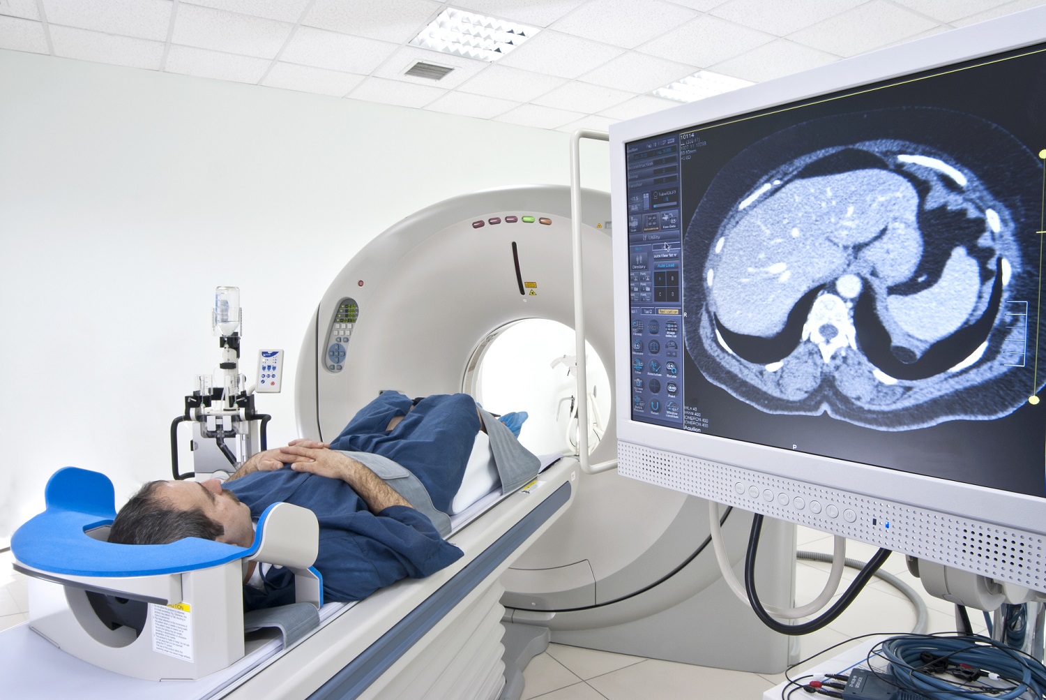 MRI
